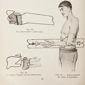 Grace Gassette, forearm splint. Reynier 422.
