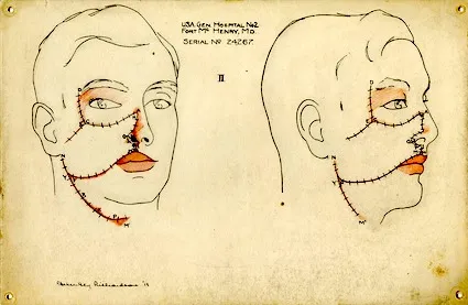 Drawing by Helen Ely Richardson, done at Fort McHenry in 1919. National Museum of Health and Medicine, facebook