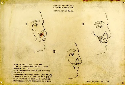 Drawing by Helen Ely Richardson done at Fort McHenry in 1919. National Museum of Health and Medicine, facebook