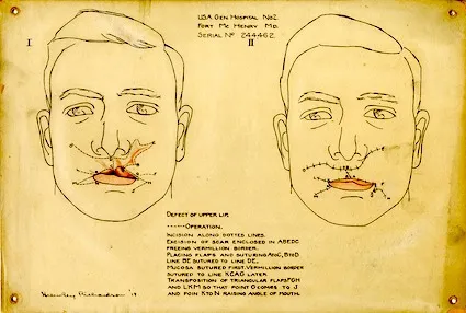 Drawing by Helen Ely Richardson, done at Fort McHenry in 1919. National Museum of Health and Medicine, facebook