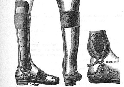 Orthopedic Instruments