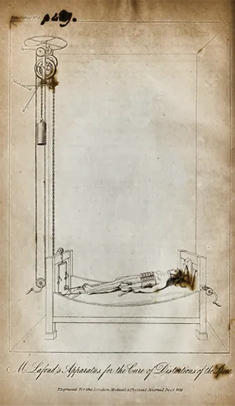 Extension bed. Shaw, John. "Distortions of the Spin: An Account of the Modes of Treating Distortions in Paris. the London Medical and Physical Journal, December 1826.
