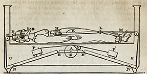 Extension bed. Shaw, John. "Distortions of the Spin: An Account of the Modes of Treating Distortions in Paris. the London Medical and Physical Journal, December 1826, p. 496.